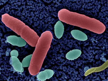 Résistance aux antibiotiques - Institut Pasteur