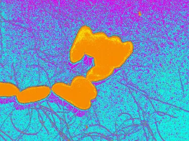 Fiches maladies - Salmonellose - Institut Pasteur