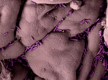 NOUVEAU MOOC  Résistance aux agents antibactériens 