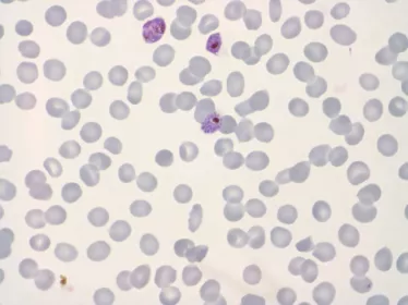 Transgenic P. falciparum schizont stage parasites with a natural polymorphism vaccine candidate antigen