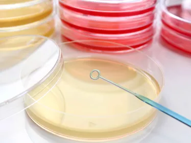Le surcoût annuel des infections à bactéries résistantes en France estimé à 290 millions d'euros