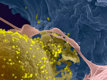 Françoise Barré-Sinoussi et ses travaux sur le virus VIH1 - Institut Pasteur