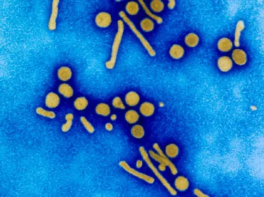 Viruses and  Human Cancers