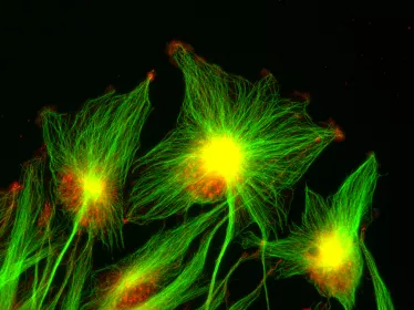 Cancer Initiative at Institut Pasteur