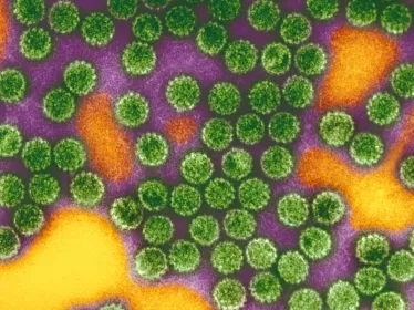 Papillomavirus 