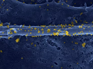 Une protéine essentielle à la réplication du virus chikungunya identifiée