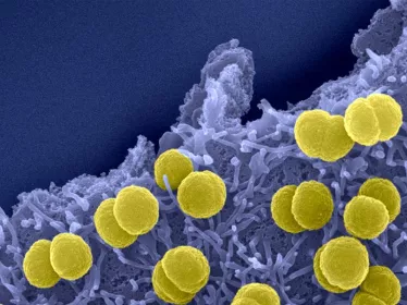 Méningites à méningocoques - Institut Pasteur