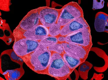 Vers de nouveaux médicaments efficaces contre le paludisme