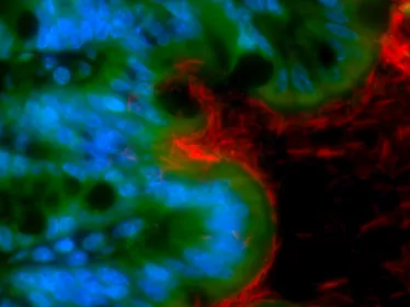 Un déséquilibre du microbiote intestinal favorise la survenue d’un cancer colorectal - Institut Pasteur