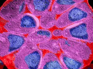 Vers de nouveaux médicaments efficaces contre le paludisme - Institut Pasteur