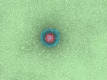 Coronavirus - SARS-CoV - SRAS - Institut Pasteur