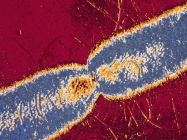 Nouvel éclairage sur la dissémination de la résistance aux carbapénèmes chez Escherichia coli