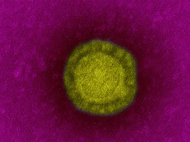 Fiche Maladie - Coronavirus de Wuhan - Institut Pasteur