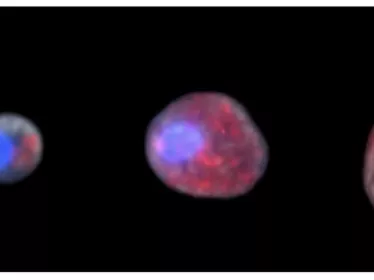 Leishmania - Institut Pasteur