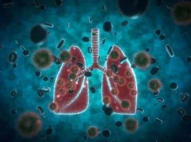 Covid-19 - poumons - lung - Institut Pasteur