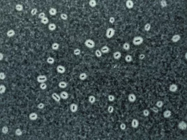 Klebsiella - Institut Pasteur