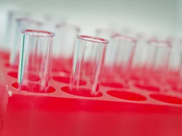 COVID-19 : un projet vaccin lentiviral par voie intra-nasale assure une protection importante chez l’animal
