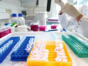 About us - Innovation - Institut Pasteur 