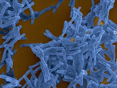 MOOC Tuberculosis 2020 - Institut Pasteur