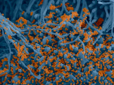 Photo d'un coronavirus réalisée par microscopie électronique et colorisée