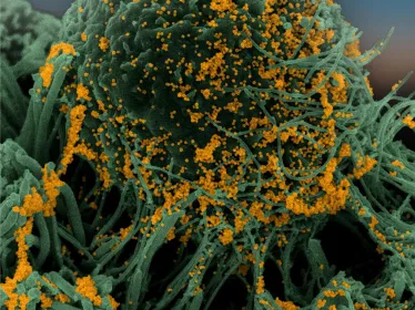 Coronavirus - SARS-CoV-2 - Institut Pasteur
