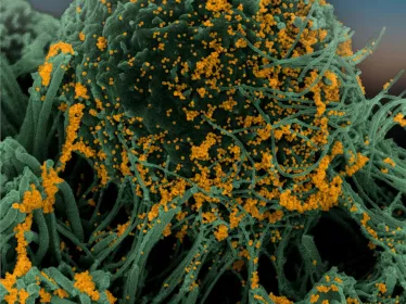 SARS-CoV-2 (c) Institut Pasteur