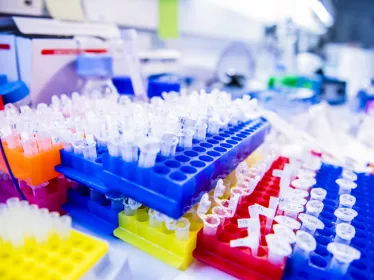 Surveillance des facteurs de risque COVID-19 chez les personnels de santé africains : une étude mise en place via le projet MediLabSecure