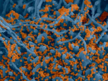 Crédit : Institut Pasteur. Image par Rémy Robinot, Mathieu Hubert, Vincent Michel, Olivier Schwartz et Lisa Chakrabarti, et colorisée par Jean Marc Panaud