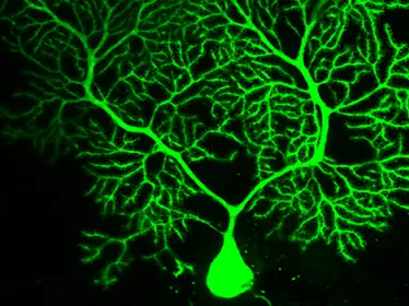 Brain connectivity and neurodegenerative diseases