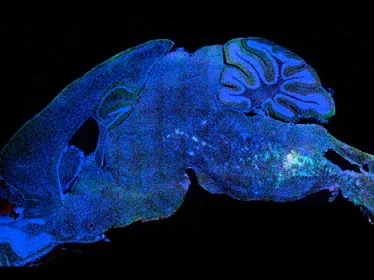 Brain connectivity and neurodegenerative diseases - Institut Pasteur