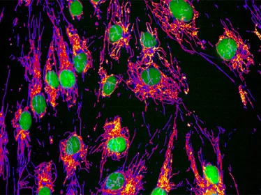 Brain connectivity and neurodegenerative diseases - Institut Pasteur