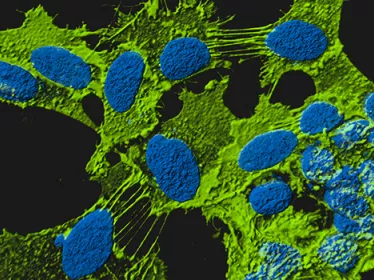 Brain connectivity and neurodegenerative diseases - Institut Pasteur