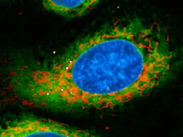 Legionellose : mécanisme inédit de régulation de la réponse immunitaire des cellules hôtes par la bactérie Legionella pneumophila