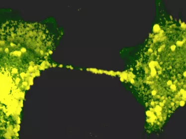 Le SARS-CoV-2 détourne les nanotubes reliant les neurones afin de les infecter