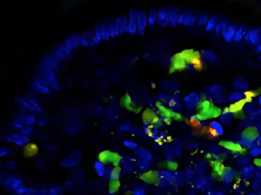 cellules lymphoïdes innées de type 3 - Institut Pasteur