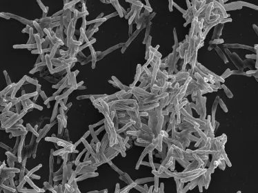 Mycobacterium tuberculosis, agent de la tuberculose. Microscopie electronique à balayage.