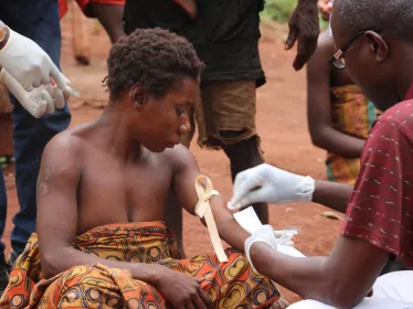MonkeyPox - Institut Pasteur - Institut Pasteur de Bangui