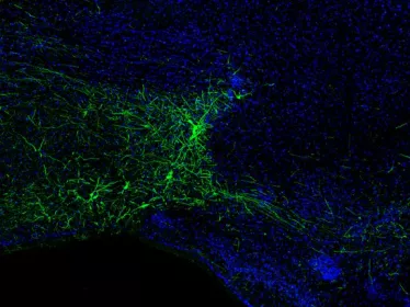 Image de microscopie montrant par fluorescence des neurones inhibiteurs (en vert) découverts dans le système olfactif. © Institut Pasteur/Gabriel Lepousez