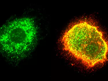 Macrophage humain infecté par le virus Lassa (Arénavirus) 
