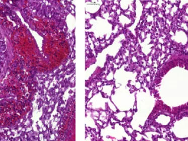 Nouvelle étape franchie dans le développement d’un vaccin efficace contre l’asthme allergique