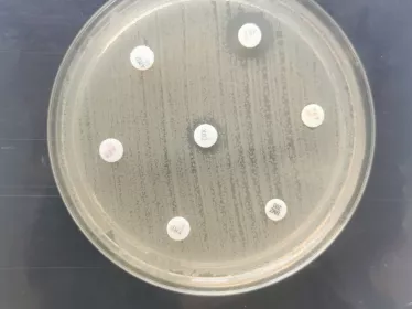 Emergence en France d’une souche de Shigella sonnei hautement résistante aux antibiotiques