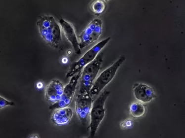 Cryptocoques en interaction avec des macrophages - Institut Pasteur