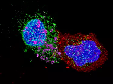 LTCD8 rentre en contact avec un LTCD4 infecté par le VIH - © Institut Pasteur