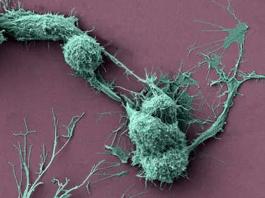 Deux cellules neuronales (CAD) en connexion par un nanotube TNT © Institut Pasteur/Karine Gousset et Chiara Zurzolo,