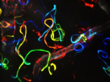 Migration des sporozoïtes de Plasmodium dans la peau © Institut Pasteur/Pauline Formaglio et Rogerio Amino