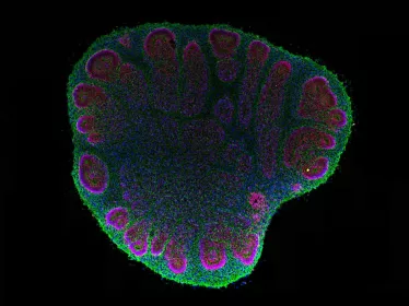 Observation d'un organoïde cérébral de 2 mois au microscope