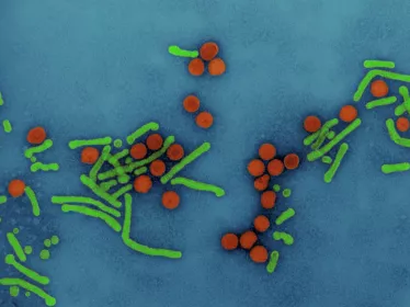 Virus de l'hépatite B (VHB)