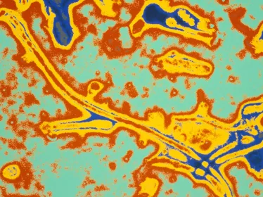 Pasteur Filovirus