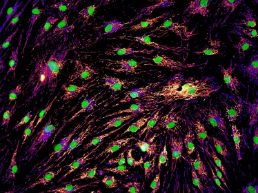 réseau mitochondrial © Timothy Wai / Institut Pasteur
