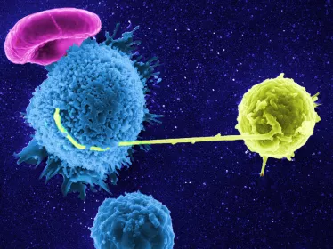 Contact entre un lymphocyte infecté par le VIH (en jaune) avec un lymphocyte non-infecté ©  Institut Pasteur/Stéphanie Guadagnini et Marie-Christine Prévost